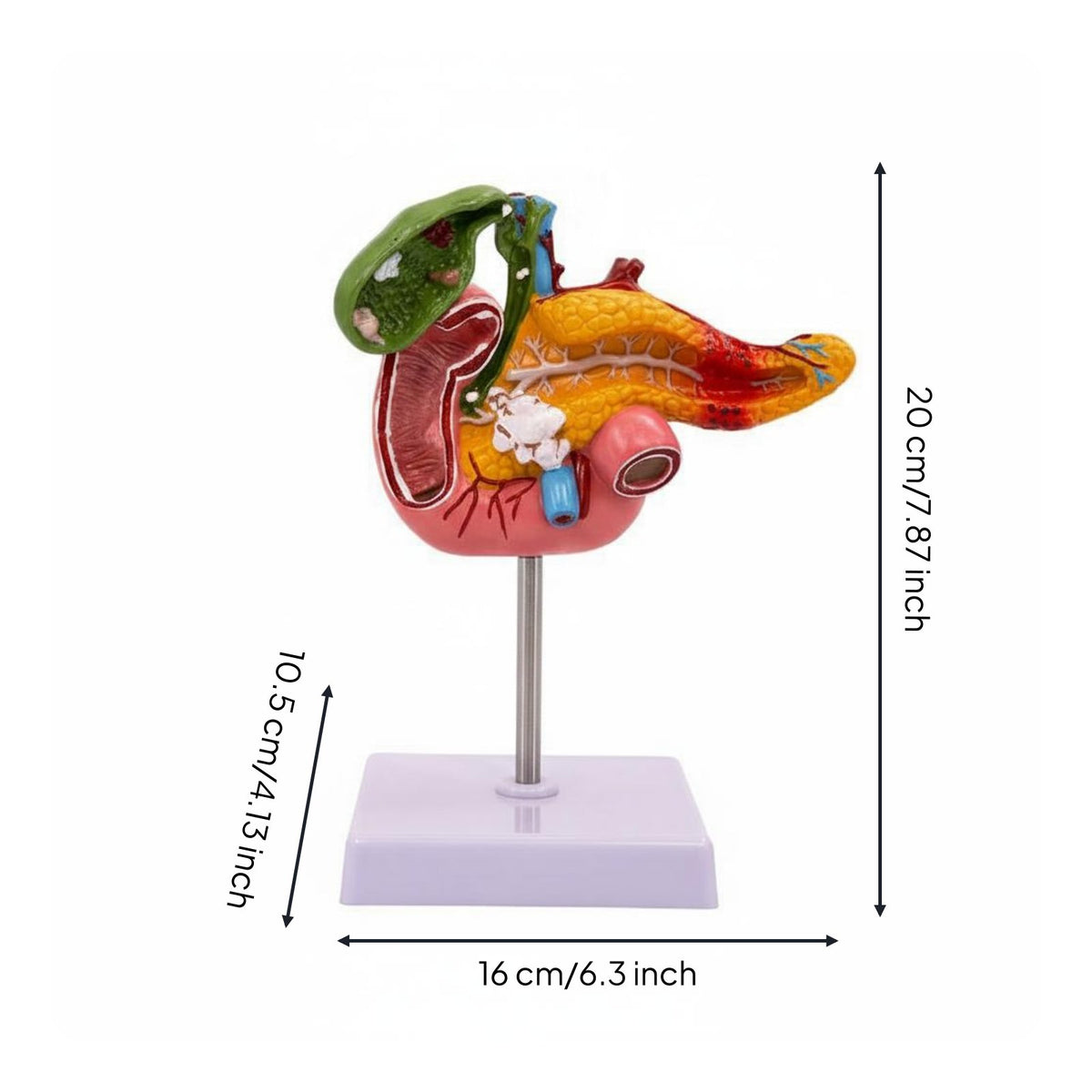 Digestive System Pathology Model Display for Classroom, Science Lab