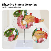 Pancreas Pathology Model Multicolored Mounted Anatomy Display Realistic Texture