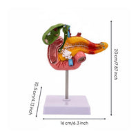 Digestive System Pathology Model Display for Classroom, Science Lab