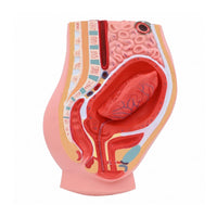 Postpartum Pelvis Model Anatomically Detailed Placental Detachment Model